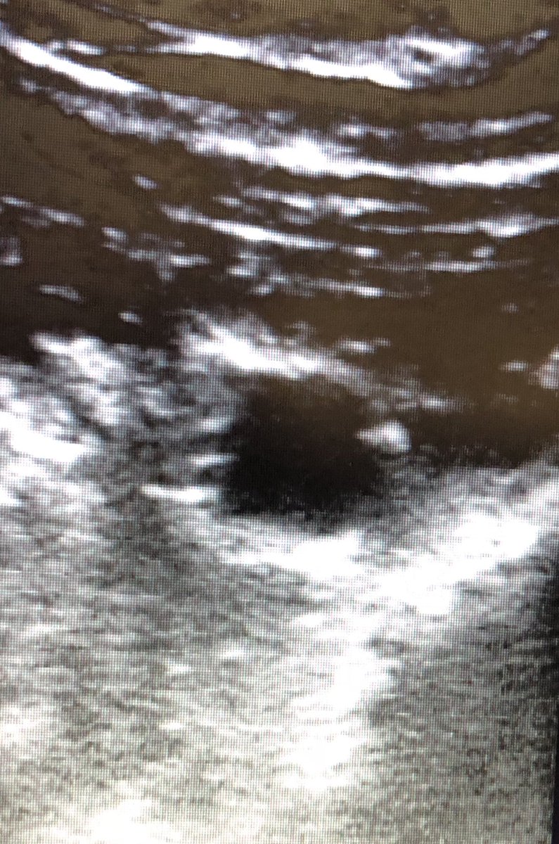 agtruesdell's tweet image. 2/3: #PercAx access...