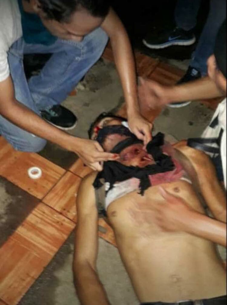 EliRuizToruno's tweet photo. @jorgeramosnews Esto acaba de ocurrir por favor haga algo por la juventud que se está levantando en contra de este maldito pueblo https://t.co/o2LTvWaHYq
