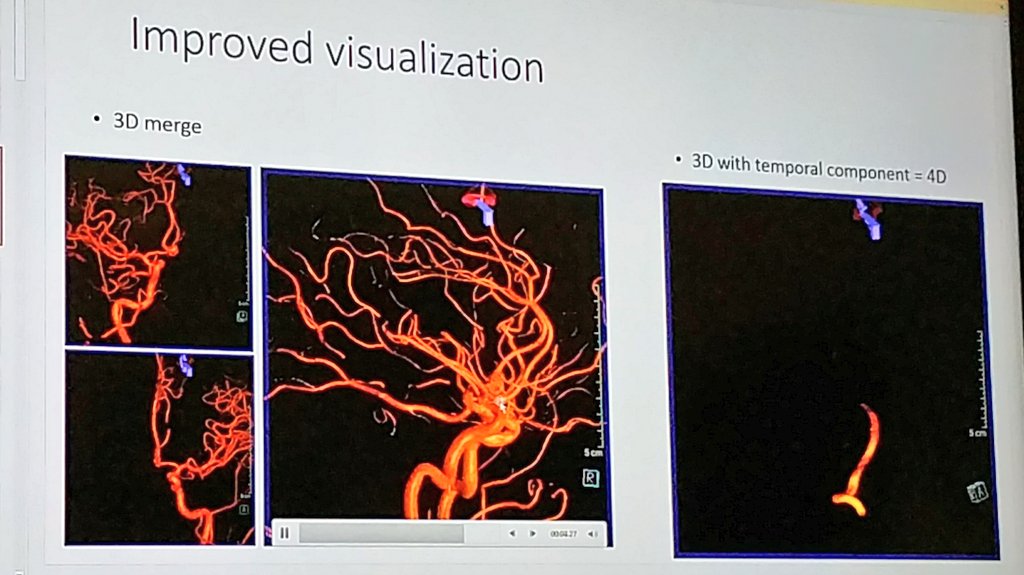 BethBaldauf's tweet photo. Thanks to Dr. Mangubat with @PalmettoHealth for an update on treatment advances at #ColumbiaSC's @JoeNiekro #BrainAneurysm - #AVM Support Group mtg. tonight. SO GRATEFUL for incredible care #PalmettoHealth & this group of survivors + family!
#MPBStrong https://t.co/shPkLpNQLb