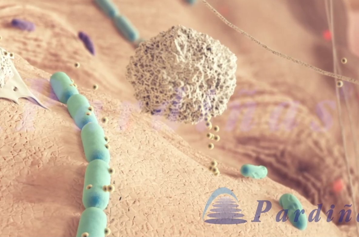 ClinicaPardinas's tweet photo. Así funciona la #osteointegración, el proceso por el cual se crear una conexión directa y funcional entre los #implantes y el hueso dental https://t.co/cw72OkBmRg https://t.co/Pnyu8NlmJa