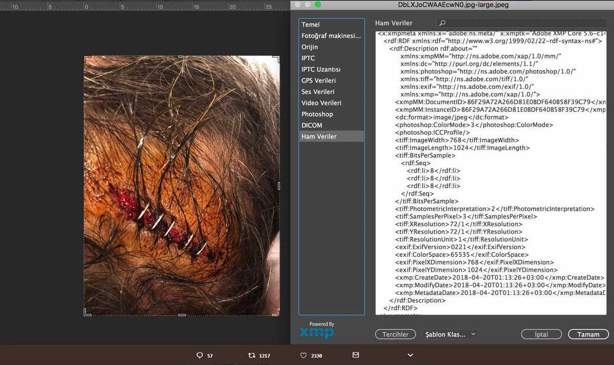 Flaş... Flaş... Flaş.... Sapasağlam sahayı terkeden Şenol Güneş'in kafasının,  Pnotoshop marifetiyle Bjk muhabirlerince yarıldığı ortaya çıktı sayın seyirciler:)))