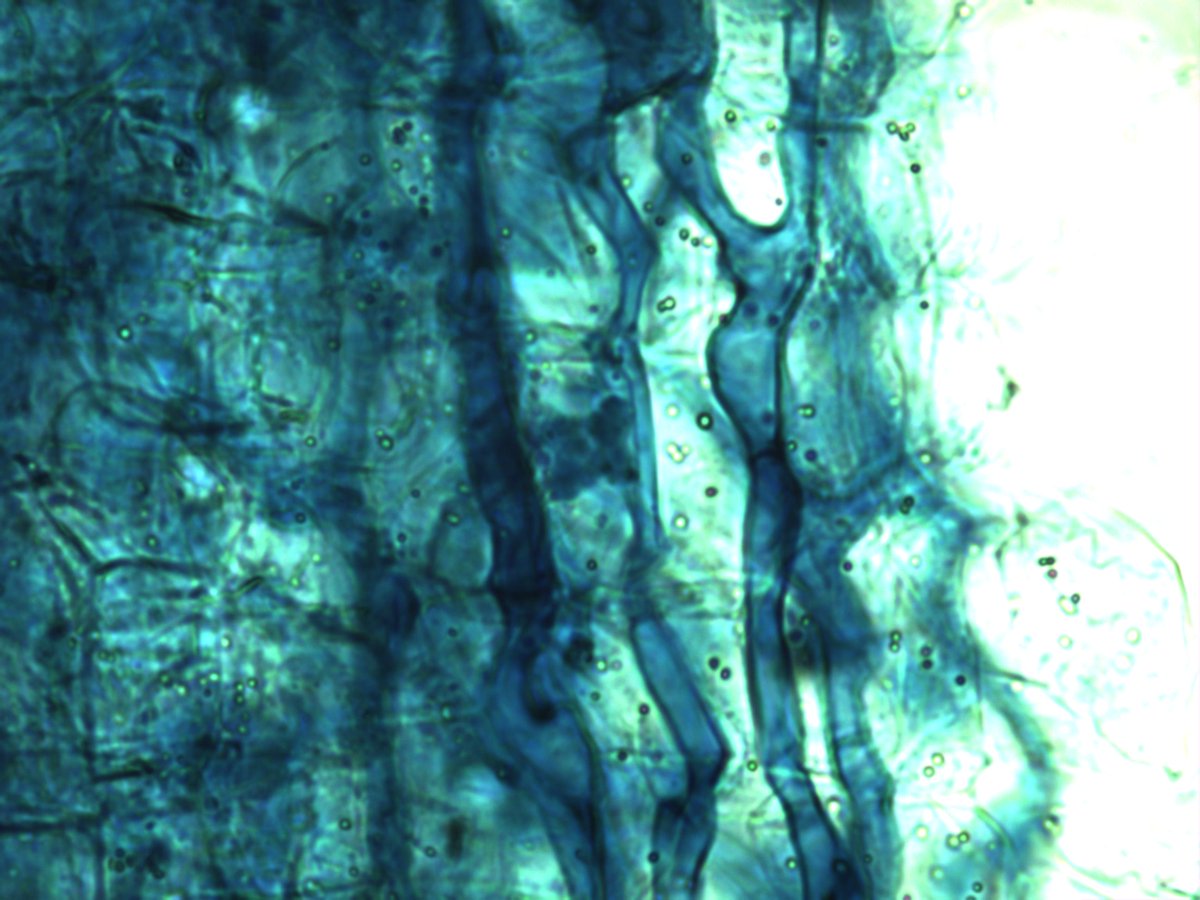 MaxymReva's tweet photo. Hifas y espora de #micorriza #arbuscular en raíces de #almendro (400X)
Hyphae and spore of #arbuscular #mycorrhiza in #almond roots (400X) https://t.co/TBidBiiWBG