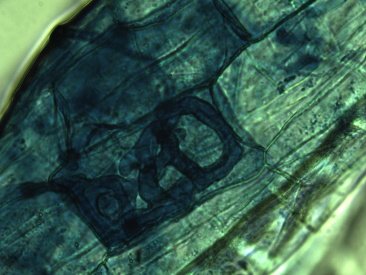 MaxymReva's tweet photo. Hifas y espora de #micorriza #arbuscular en raíces de #almendro (400X)
Hyphae and spore of #arbuscular #mycorrhiza in #almond roots (400X) https://t.co/TBidBiiWBG