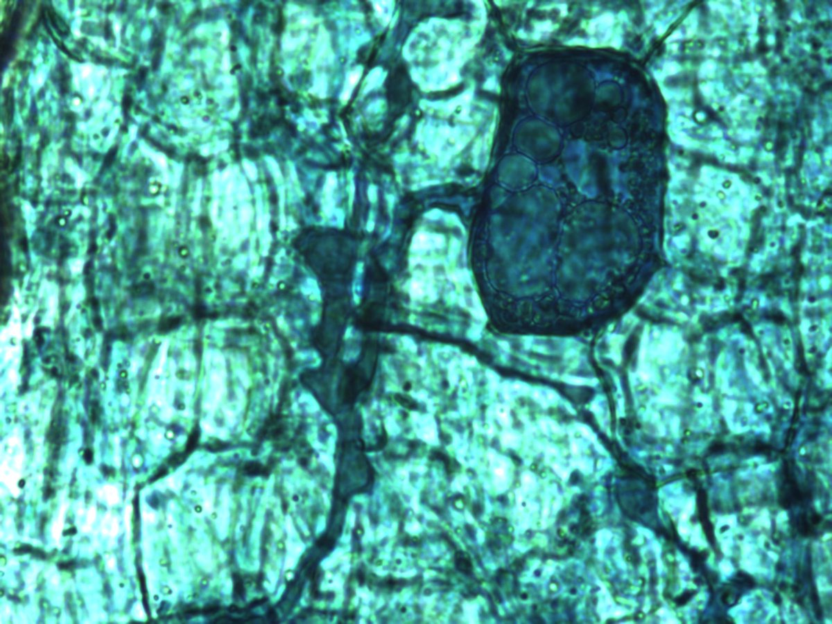 MaxymReva's tweet photo. Hifas y espora de #micorriza #arbuscular en raíces de #almendro (400X)
Hyphae and spore of #arbuscular #mycorrhiza in #almond roots (400X) https://t.co/TBidBiiWBG