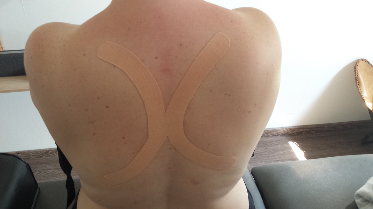 De eerste tape tegen hooikoorts is weer een feit! Heb jij ook last van hooikoorts? Stuur een pb of bel 0615664102 #hooikoorts #medicaltape #pinotape