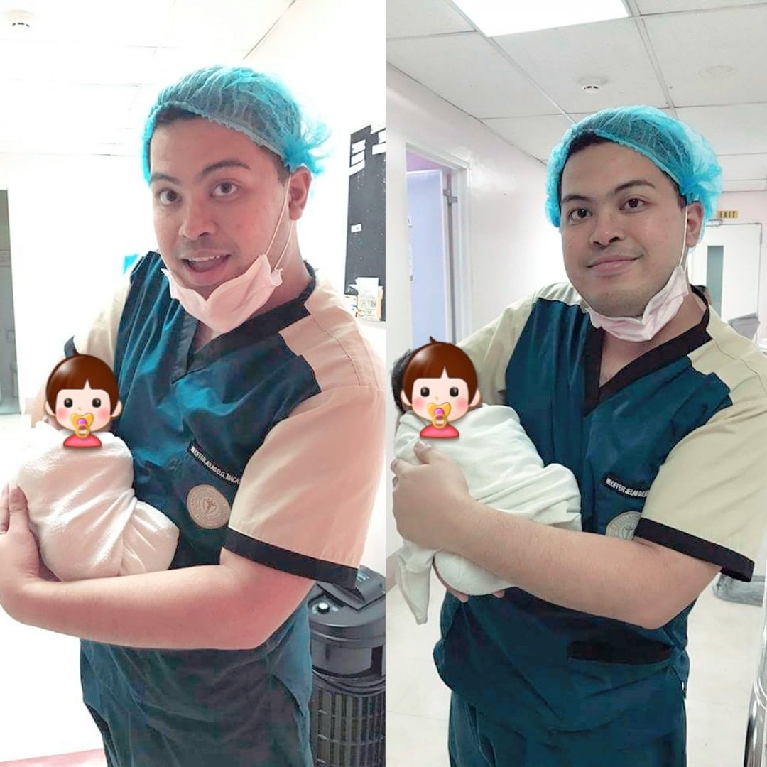 NEOawesomeness's tweet image. APRIL 19 2018
Was able to catch two baby boys on my birthday! 😍
So we now share a the same birthday! 🎉Will never forget the adrenalin rush when these two gifts from God came - that #DoubleTable day! 😁
4:30 pm and 4:38 pm

#BirthdayDuty #Pedia #NICU