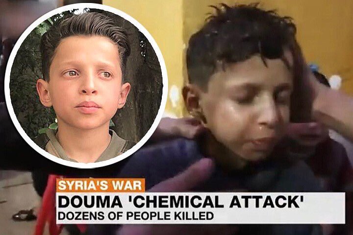 BaharKimyongur's tweet photo. L’histoire se répète.
À Alep, le petit Omran Daqneesh et son papa,victimes collatérales des combats,avaient refusé de servir une campagne internationale contre leur pays. 
À Douma,le petit Hasan Diab et son papa, victimes de l’attaque du 7 avril, nient avoir été gazés par l’armée https://t.co/pWS1wmNN5a