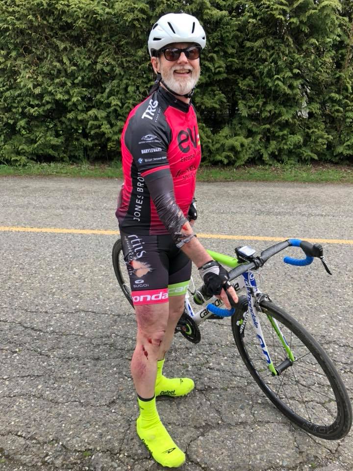 EVcycling's tweet photo. Winner winner chicken dinner! Congrats to Robert Allan McLaren on winning the @SUGOI_Apparel , @RideCannondale and @BSPBikes #SpringSeries2018 photo contest. Hopefully this prize pack can help ease some of those scrapes and bruises 😉 https://t.co/ReFW4JJzsc
