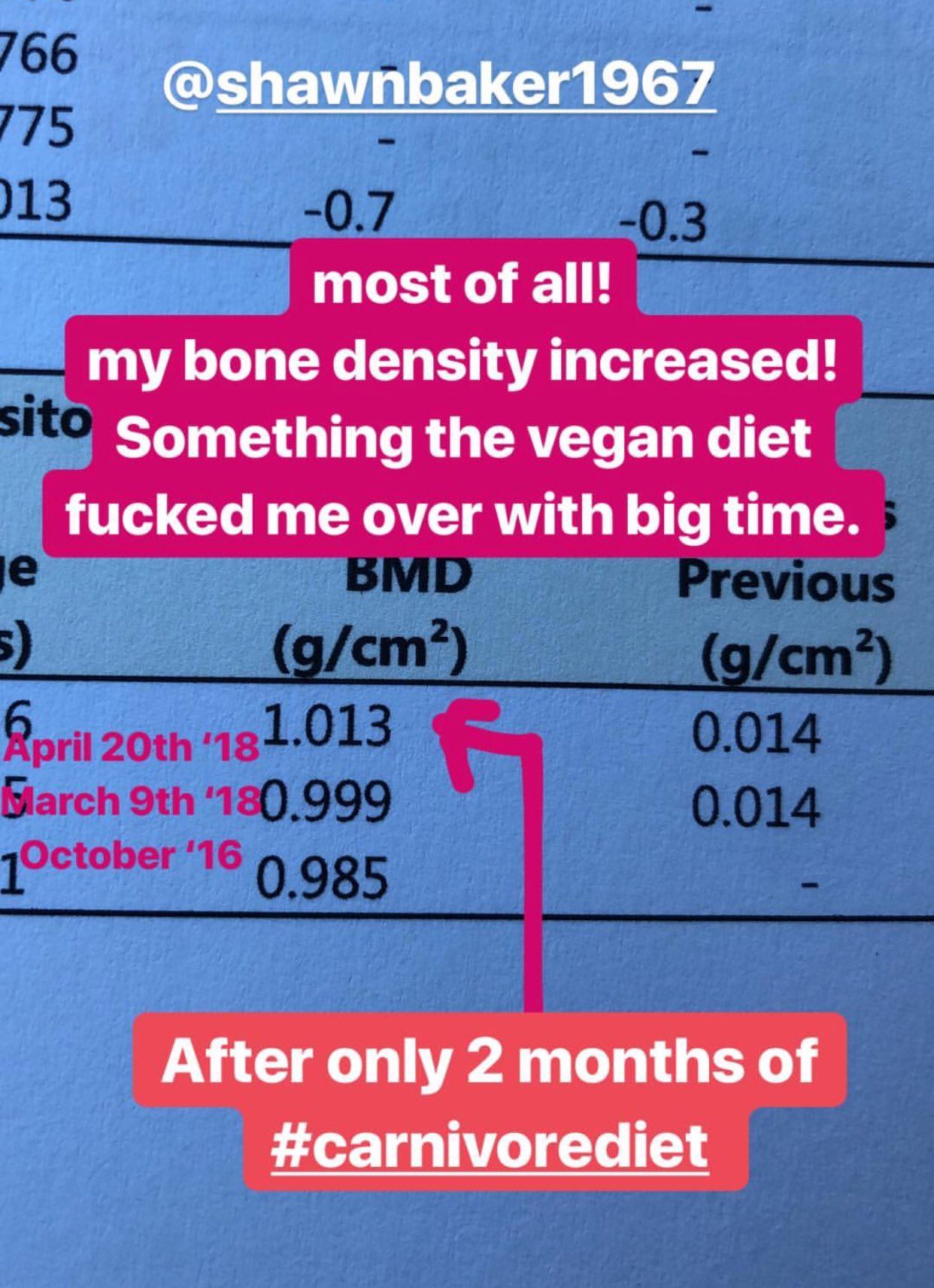 Dr Shawn Baker 🥩 on Twitter "Can a carnivore diet improve bone mineral