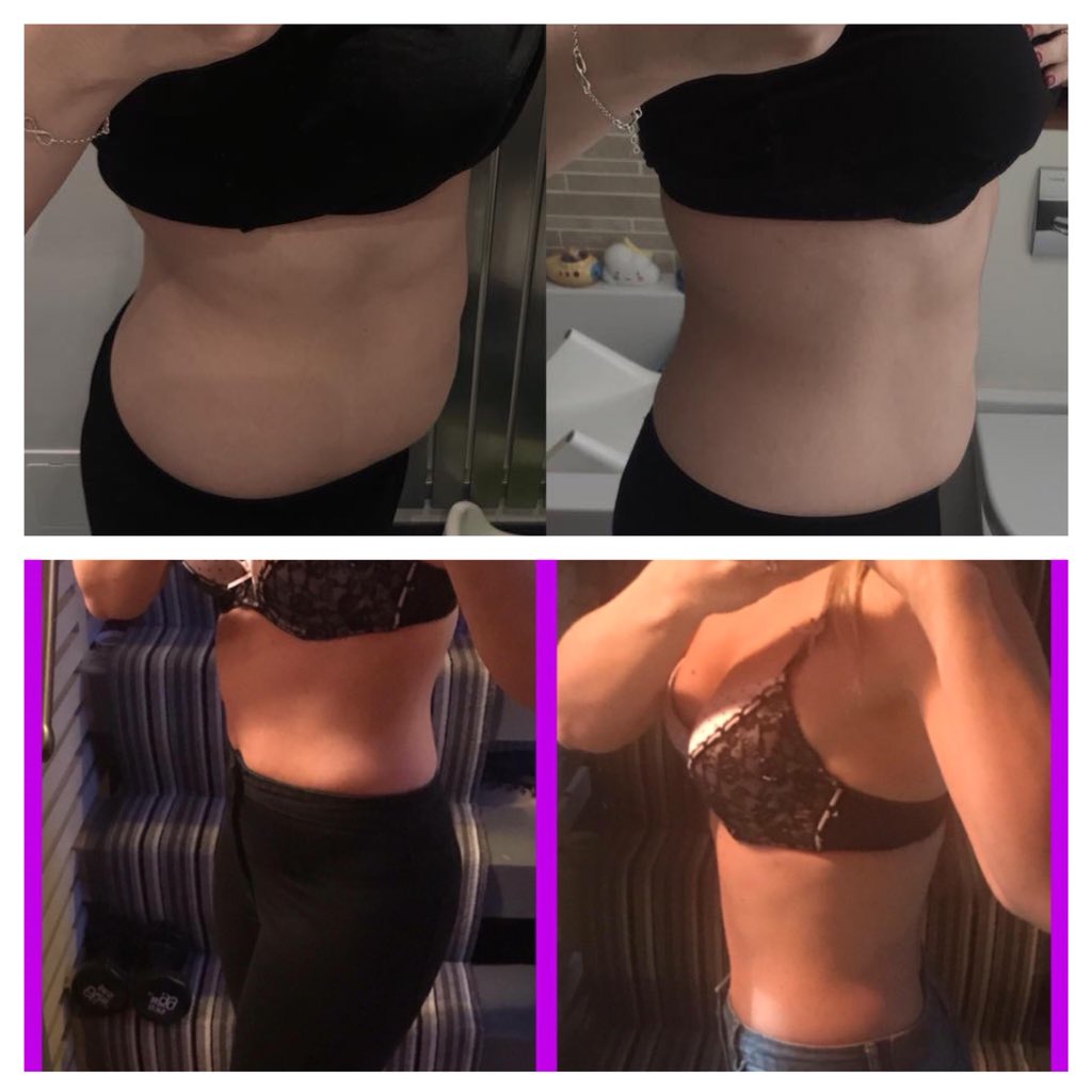 JadeJosephX's tweet photo. 👙ARE YOU READY TO GET SHREDY?👙 

Our SHRED10 package is on🔥🔥🔥
Fab results just after 10 DAYS!!! WOW😍

Message me for more details hunny’s💌😘
#shred10 #juiceplus https://t.co/qdHnic5yGd