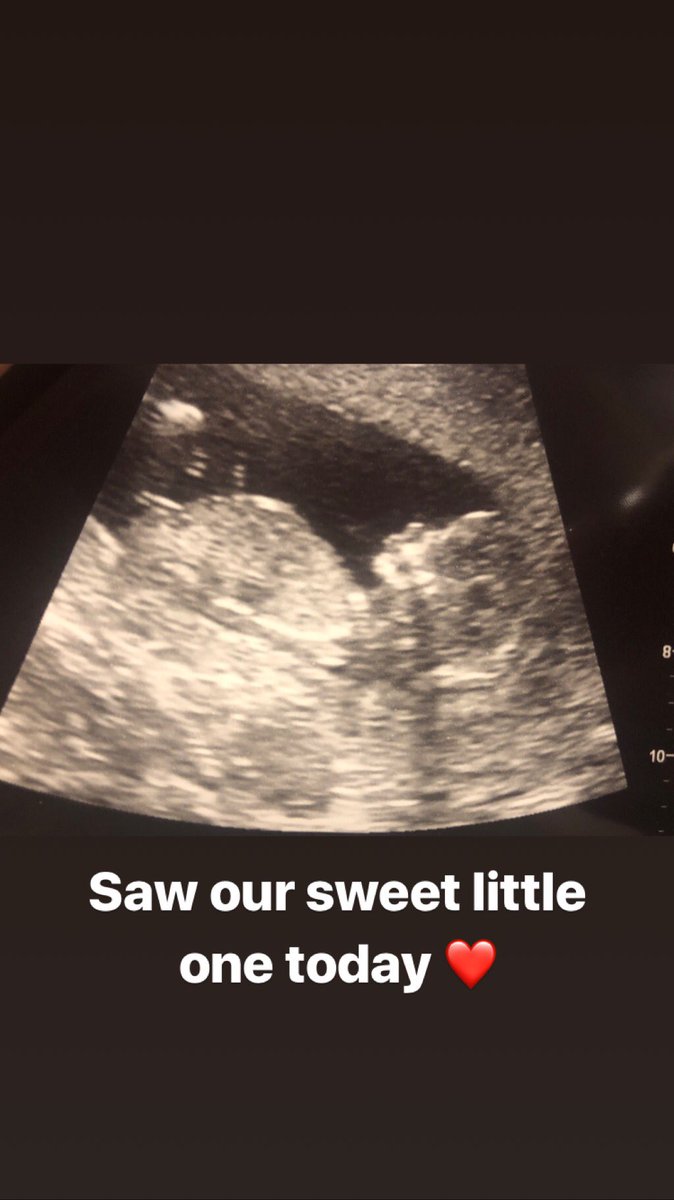 SierraBlakeSugg's tweet photo. @MediumKareen am I having another boy ? https://t.co/gkc1h6irlg