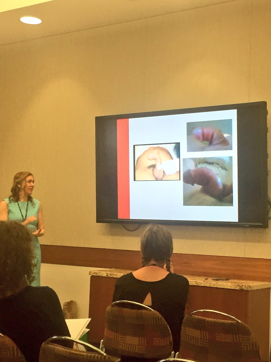 Yes, you can break your penis during sex! @DrRoseHartzell says it happens most often during woman on top sex. 😱