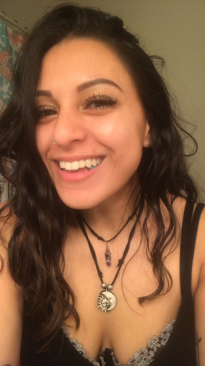 thetinatrish's tweet image. ground breaking news!! this scar on my lip has been crumbling my self confidence, and for the first time it truly m feels like a part of me, and not just some ugly imperfection