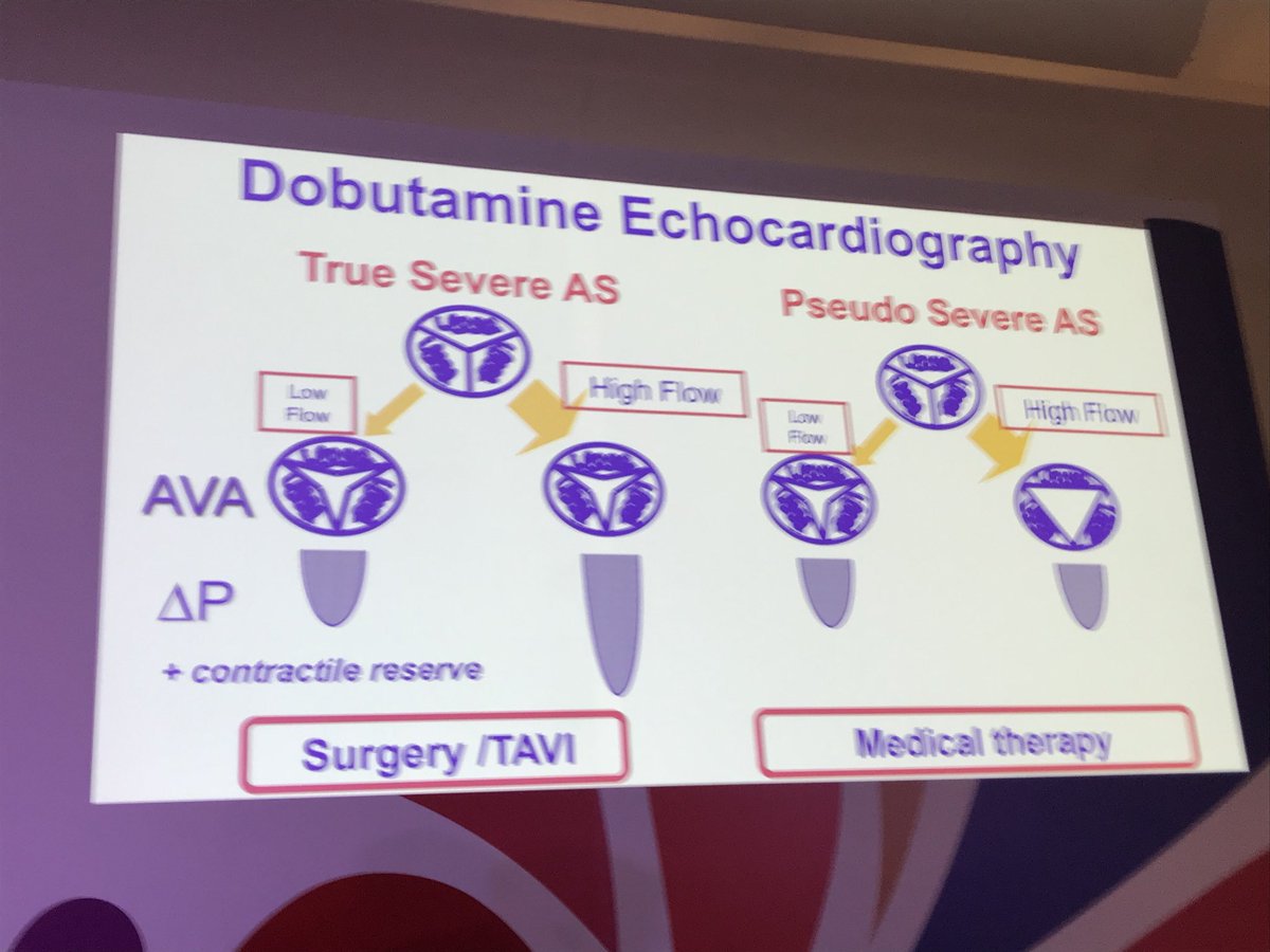 biljana_parapid's tweet image. My ❤️ is full every time 1 of my #Fellowship #DFMSA #Mentor #Bichat 🏆 Pr. #Iung is in #Belgrade now 4 #CardioS2018

#AorticStenosis #Echo #ESC #ACCWIC #ACCFIT #Guidelines

@gabrielsteg @sfcardio @jbcuzin @DrMarthaGulati @MartineGilard @bcostelloMD @RigolinVera @DrToniyaSingh