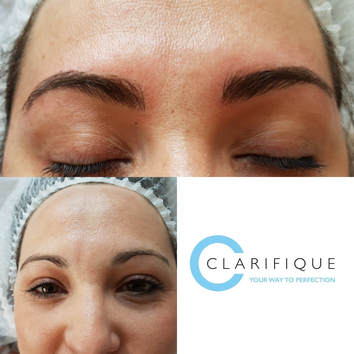 Clarifique1's tweet photo. Giving more definition to this ladies brows, great results 😍 #microblading #nursepractitioner #beauty #nurse #dudley #WestMidlands #brows #aesthetics https://t.co/7GEgBfZKzn