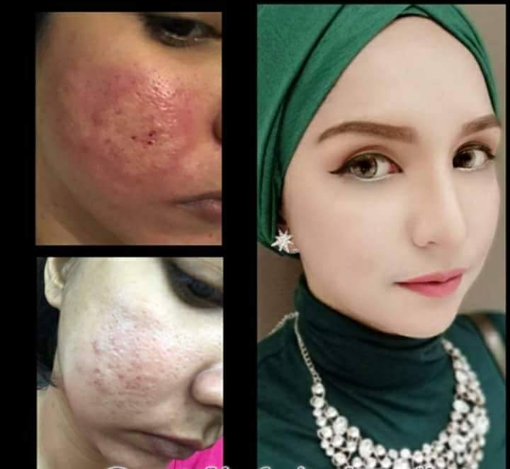 NRaziff's tweet photo. @Twt_IklanMY @twt__promote @Twt_niaga @tv3malaysia 

Transformasi hebat dari cinderella untuk anda..jom secantik cinderella,raya x lama je lagi ni uolss.. https://t.co/LHK7aq3ILW