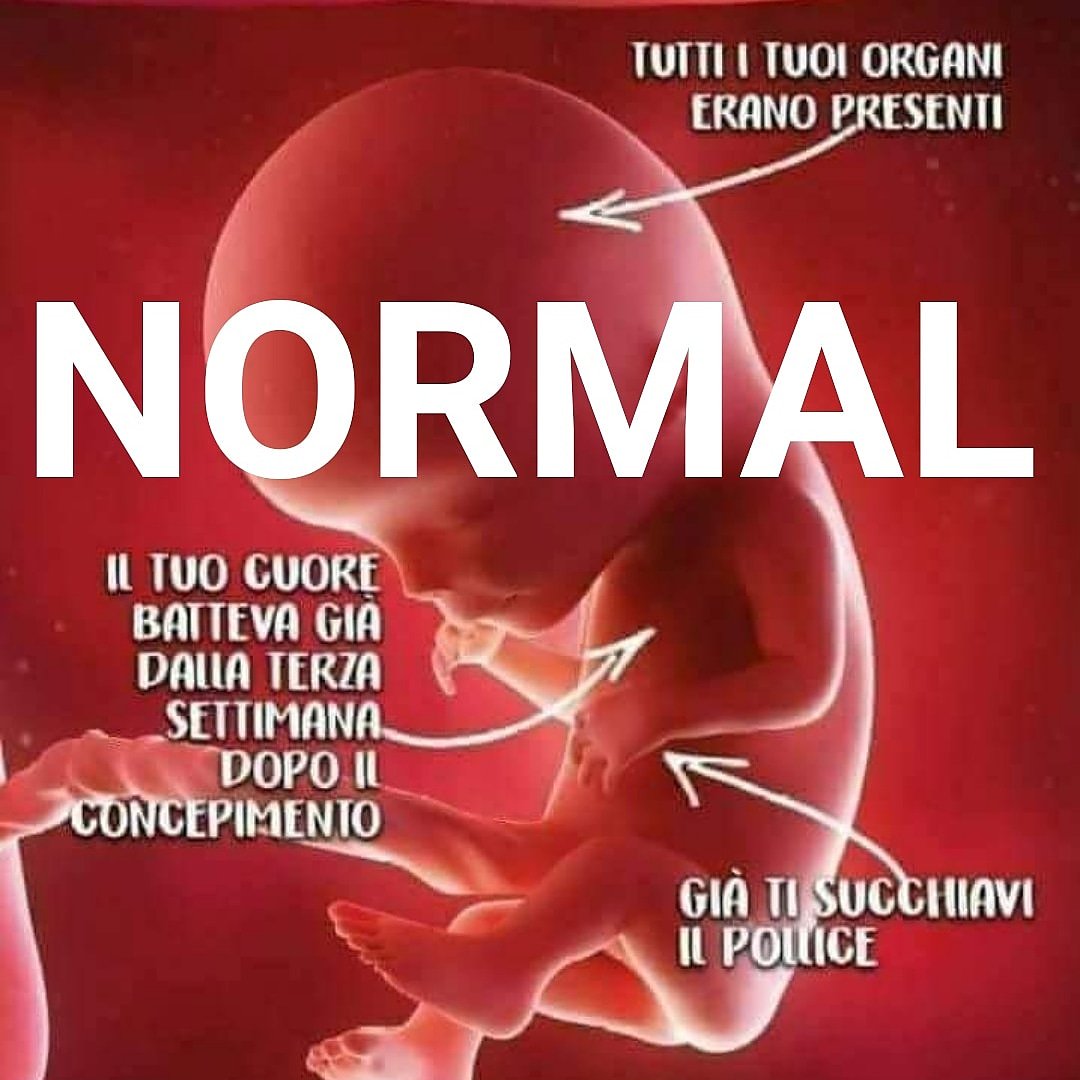 pdftrento's tweet photo. Spieghiamo ai nostri figli cosa è normale! #sìallavita https://t.co/99fJNdc3Or