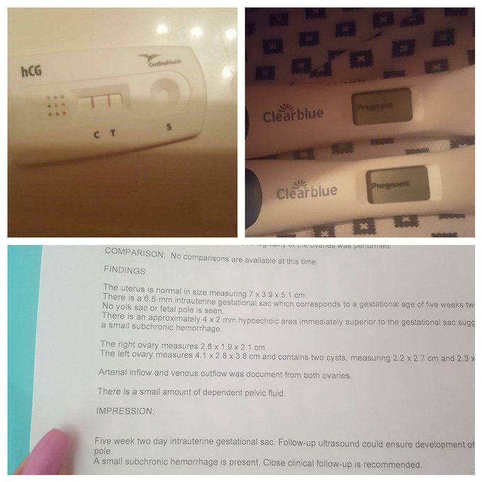 Woke up feelings bitter sweet wondering what you would have looked liked, your personality, your voice