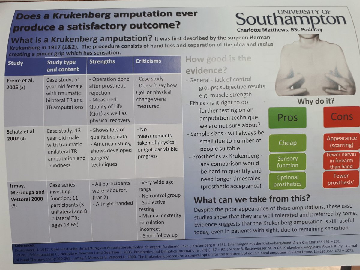 CharlotteMpod's tweet photo. check out this months BACPAR journal for my poster on the Krukenberg amputation! https://t.co/hWgmZwx7Wk