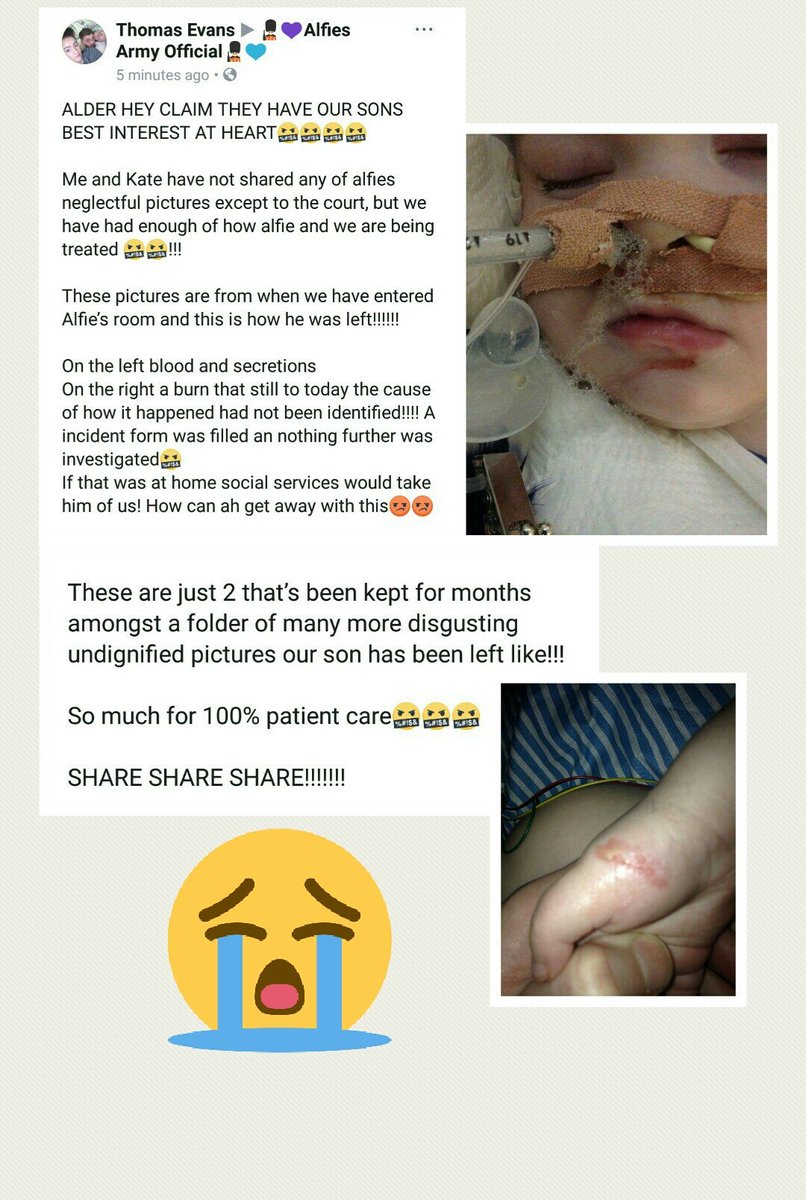 RandomLilToad's tweet photo. This is so sad π #AlfiesArmy #SaveAlfieEvans #ReleaseAlfieEvans #FitToFlyFitToTry π π π π π https://t.co/tDNaNQLhcA