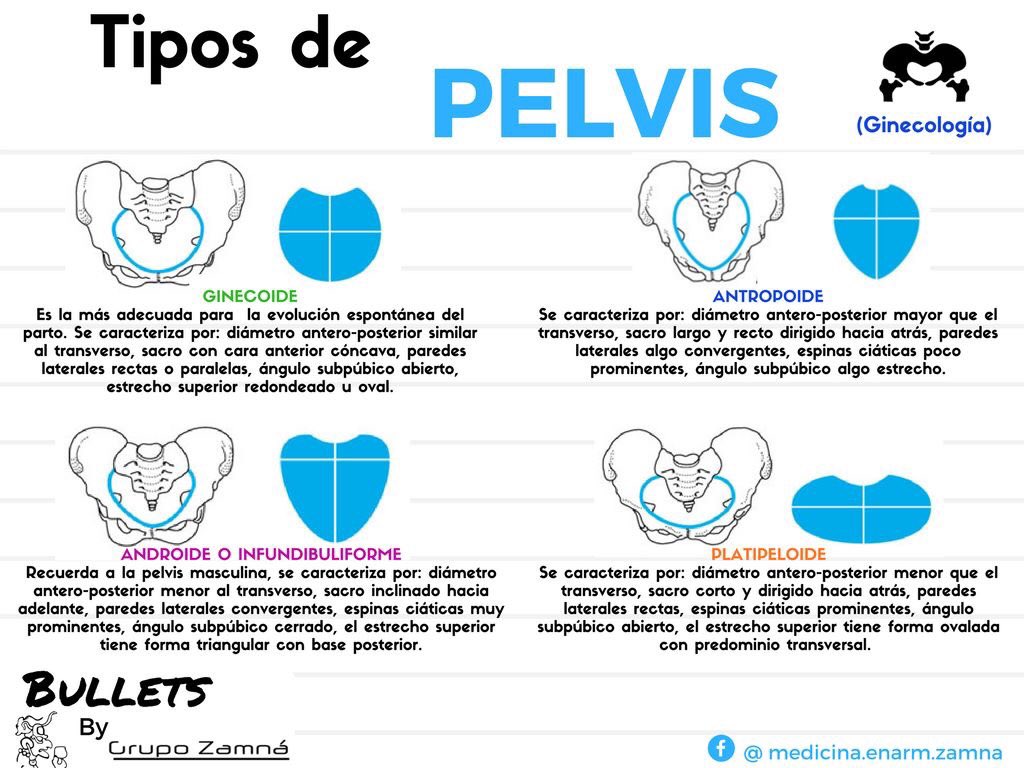 Tipos De Pelvis Tipos De Pelvis