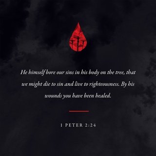 Calathia1's tweet photo. Who his own self bare our sins in his own body on the tree, that we, being dead to sins, should live…
https://t.co/whjgfvmCP3 https://t.co/ClTSk6PDOJ