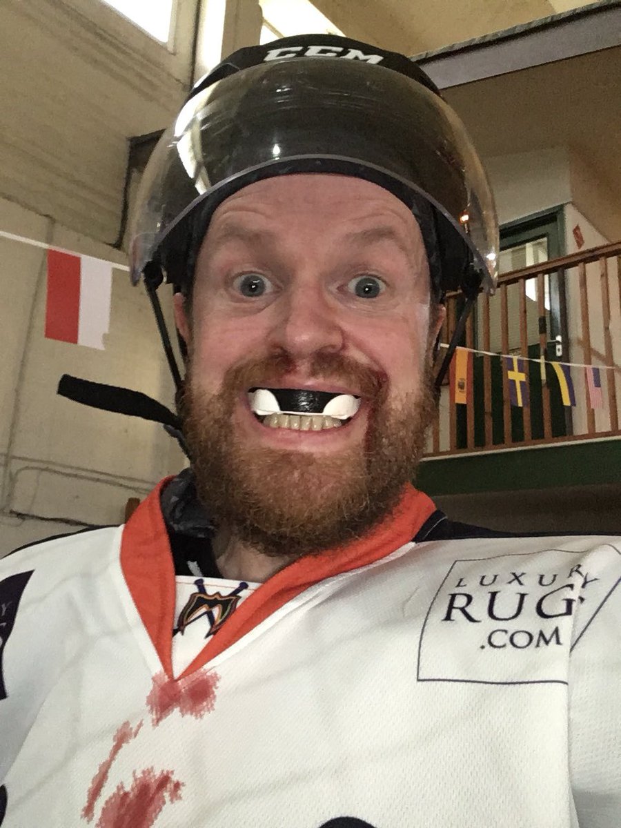 MaccWarriors's tweet image. #PuckFace. Who needs a nose anyway? #MouthguardsRule