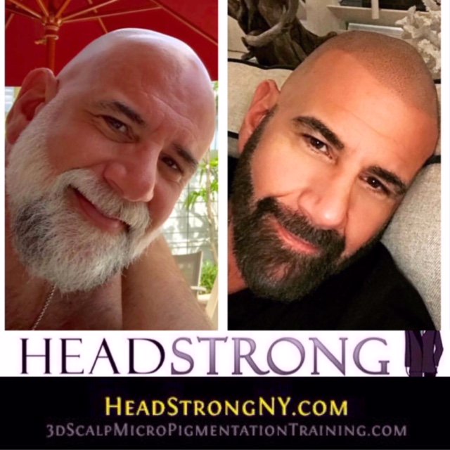 headstrongny's tweet photo. Chris transformed me with his incredible vision and his NYC Scalp Micropigmentation artistry it has profoundly changed my life. I look in the mirror now and see myself the way I was when I was young. It is truly an incredible life changing miracle.” Geo https://t.co/Tj6GkKFj42