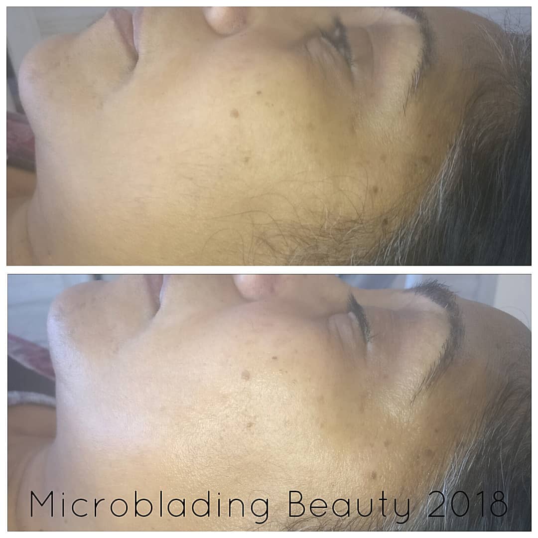 MBmicroblading's tweet photo. Dermaplane facial results - bright, smooth, glowing skin #dermaplaning #southwoodford #exfoliate #skincare #radiantskin #bbloggers @FemaleBloggerRT #beauty #London https://t.co/DPL9QGyMMG
