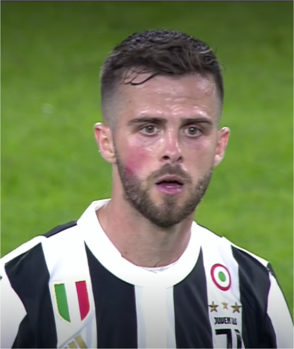 ActuFoot_'s tweet photo. Les joueurs de Juventus-Naples portent une marque rouge sur le visage, en signe de soutien contre les violences faites aux femmes. https://t.co/0KwG1oiyPS