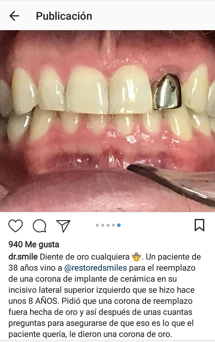 AliZpta's tweet photo. @ProyectoVi 
#saludbucodental #galeriasonrisasdesastrozas #esteticaosalud #odontologiaintegralporfavor https://t.co/ZvG49Nj3JO