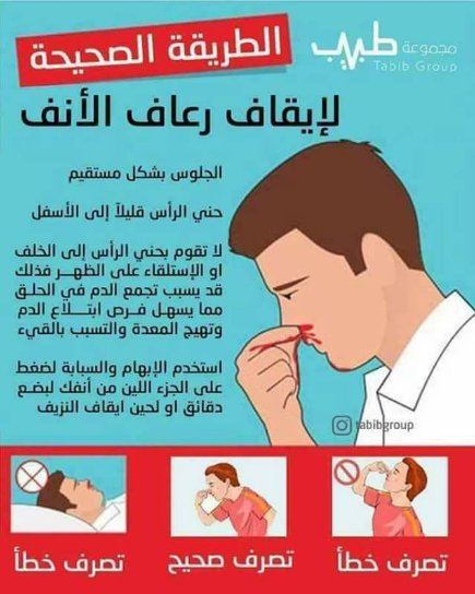 #كل_يوم_معلومة
التصرف الصحيح لإيقاف رعاف الأنف

(لا تبخل علينا بمتابعة ولا تنسى عمل شير لتفيد غيرك)

#السعوديه_اولا #العيسي_اجازه_المعلمين_طويله #مدينه_تتمني_زيارتها #وش_الشيء_اللي_يروقك_وقت_توترك