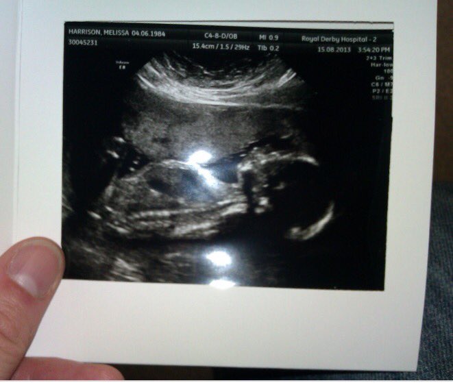 draymondart's tweet photo. Wanted. Fairly attractive pregnant couple looking 2 trade unborn child.
just had our 16 wk scan &amp; are disappointed to find out that we're expecting a baby boy. If there's anyone who knows anyone looking to swap a boy for a girl pls PM. (Ps healthy, strong 10 fingers &amp; thumbs) https://t.co/5pjqa64bHh