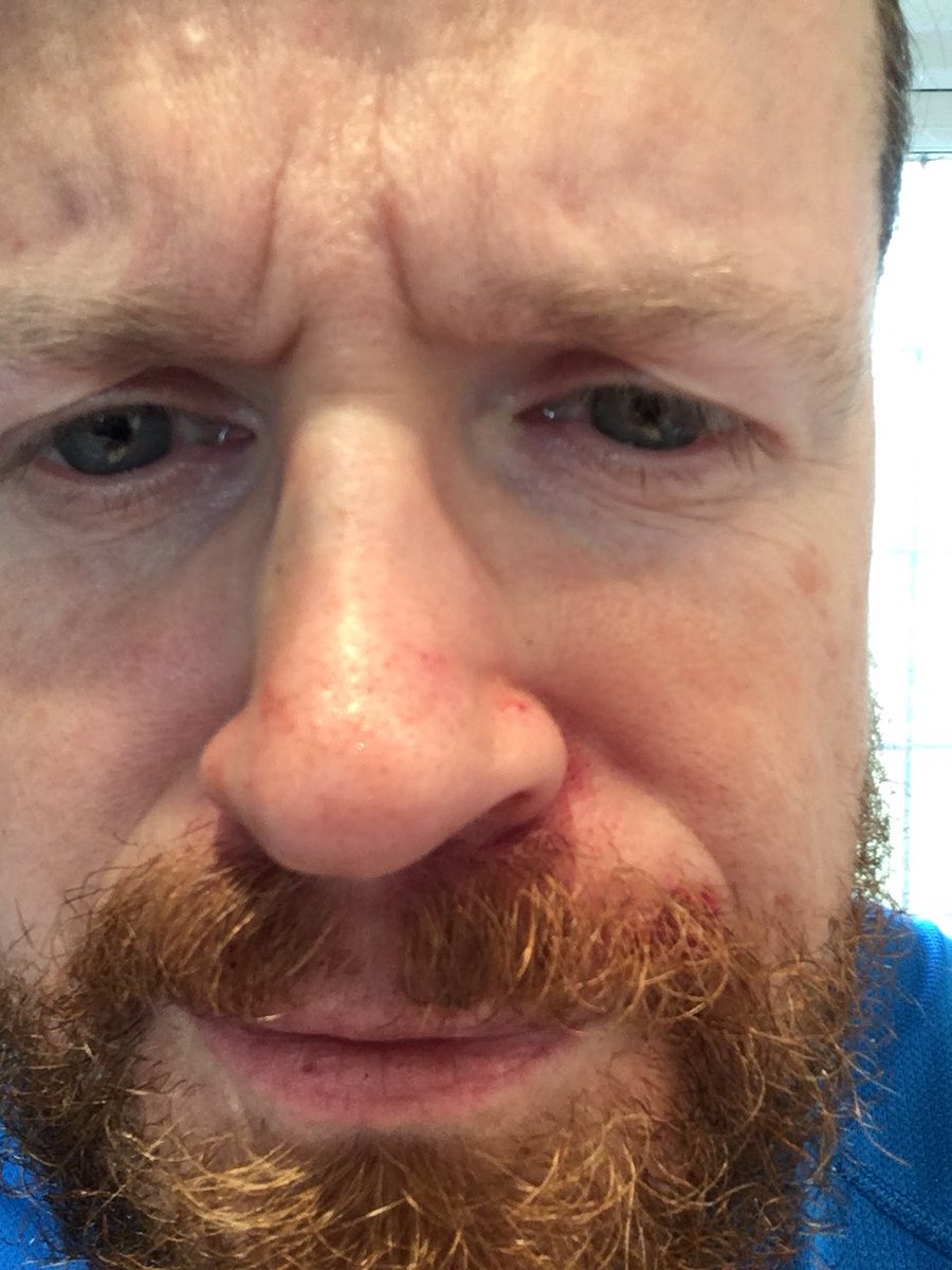 MattHeywood1974's tweet image. Definitely not right! #PuckFace