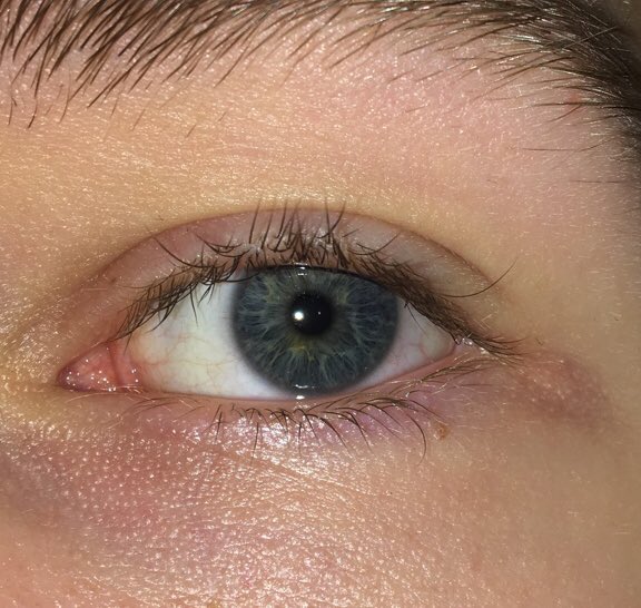 j_akethompson's tweet photo. It’s so easy to take advantage of the gift of eyesight, so here’s my #selfeye in support of the commonwealth’s efforts to beat trachoma and give sight to everybody!!!! https://t.co/FyhpBY2uL0