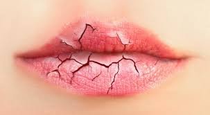 miss_ladymistic's tweet photo. ACABA YA CON LOS LABIOS SECOS Y AGRIETADOS
https://t.co/by9bkNbRUM
#belleza #lips #labios #mujer #beauty #beautytips #tipscaseros #remediosnaturales #bio #Rt #sigueme #bloggerdebelleza #beautyblogger https://t.co/38JsDqHNGH