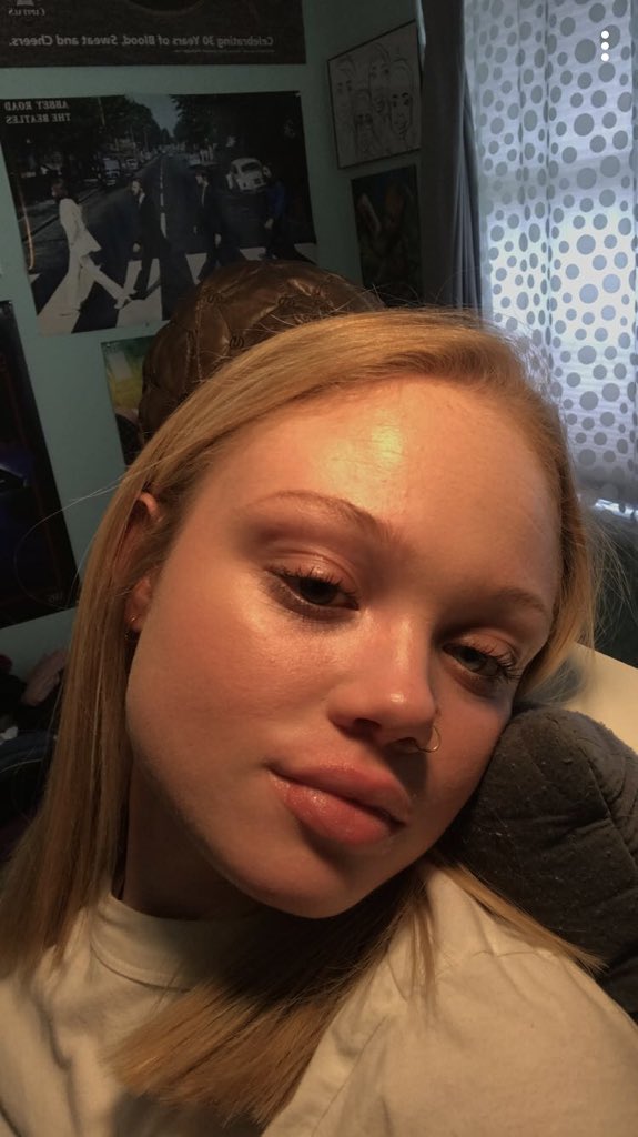 michaeladunbarr's tweet image. Acne? Don’t know her
