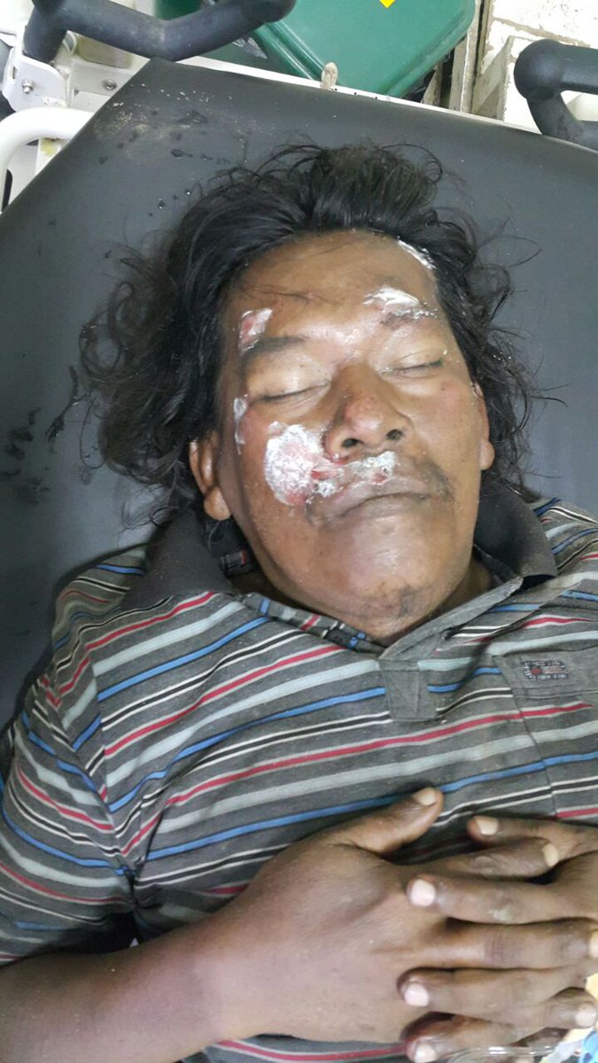 Laka daerah martapura dan sdh di evakuasi ke rs ratu zaleha mtp