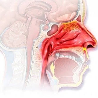 aatmadja's tweet photo. Apa penyebab mimisan pada ibu hamil?
Di Bumil terjadi ekspansi pembuluh darah di dlm hidung, peningkatan volume &amp; Sirkulasi darah akan menambah tekanan pada pembuluh darah tsb sehingga mudah pecah dan terjadilah mimisan. https://t.co/eM6Is0gsop