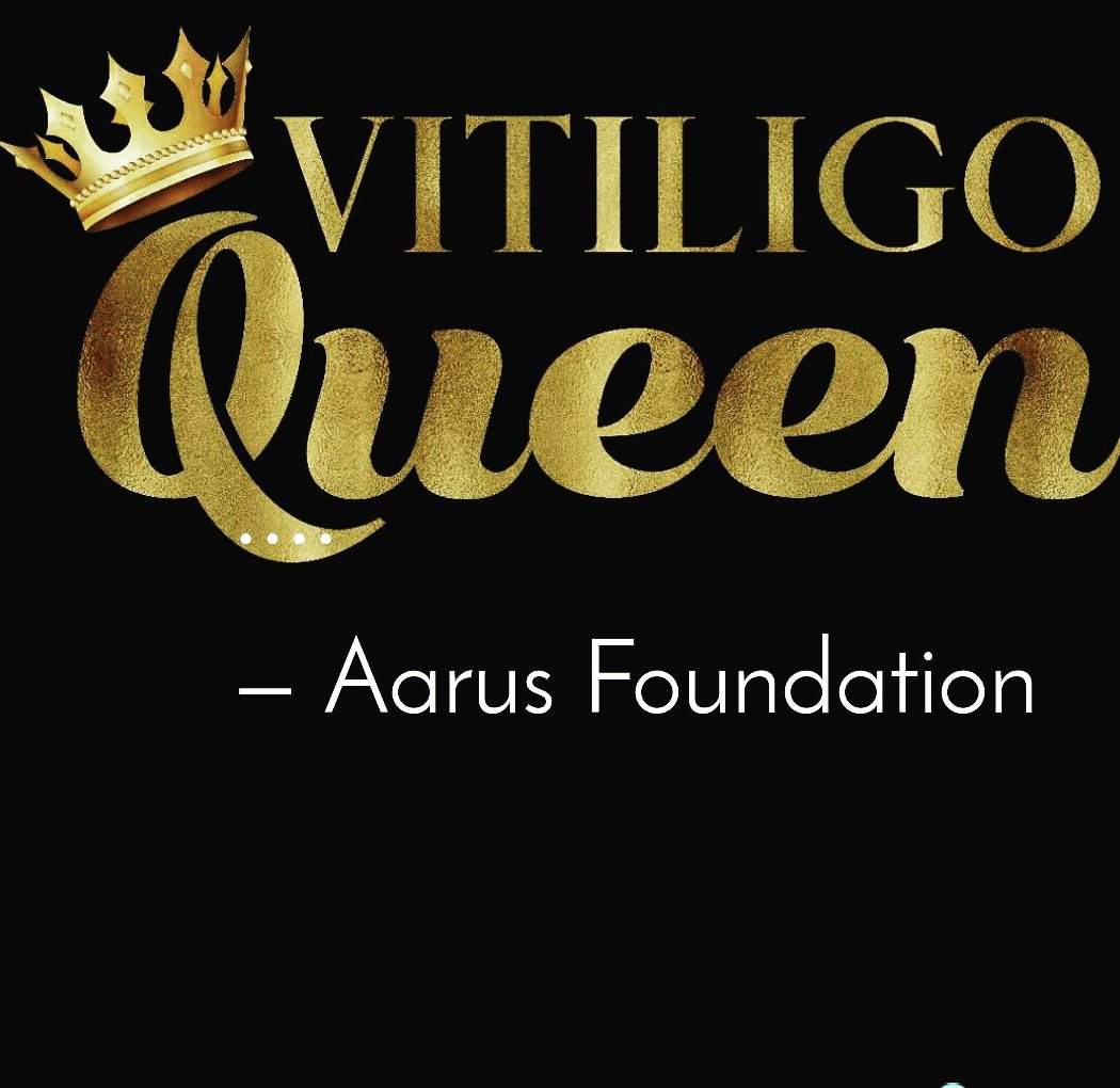 Aarusfoundation's tweet photo. I don't care what They think About me.
I'm always awesome.๐ฐ #vitiligo #vitiligoworld #vitiligans #aarusfoundation #vitiligogirls #vitiligobeauties #VitiligoconnectUs #vitiligolovers #vitiligomodel #vitiligostrong #vitiligopower #vitiligoisbeatifulโค๏ธ #vitiligoawareness. https://t.co/PkBWOdTWKF
