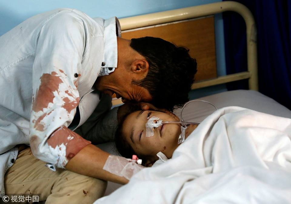 MPPAKISTAN92's tweet photo. The death toll from #Kabul blast rises to 48, with 112 others injured, Reuters reports, citing Afghan public health officials.

May Allah Protect #Afghans from #Afghans. https://t.co/NBBBgpV2SN