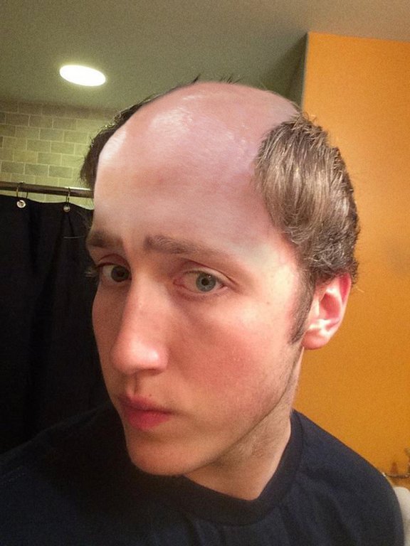 _webStorm's tweet photo. OMG! I just found a photo of FaZe Banks without his hat on. Holy shit! No wonder he wears a hat all the time. https://t.co/ZRZwx3T1wj