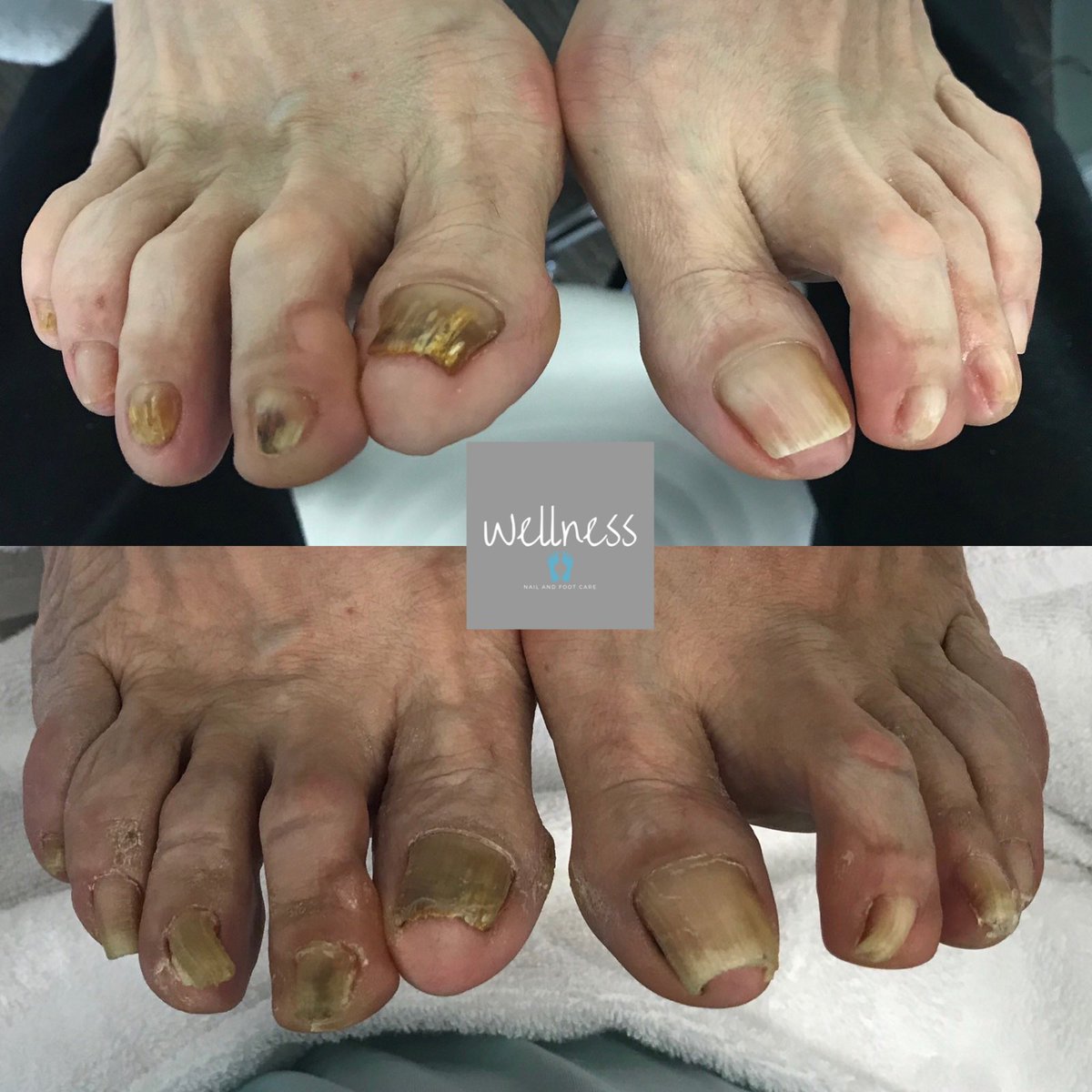 WellnessFoot tweet picture
