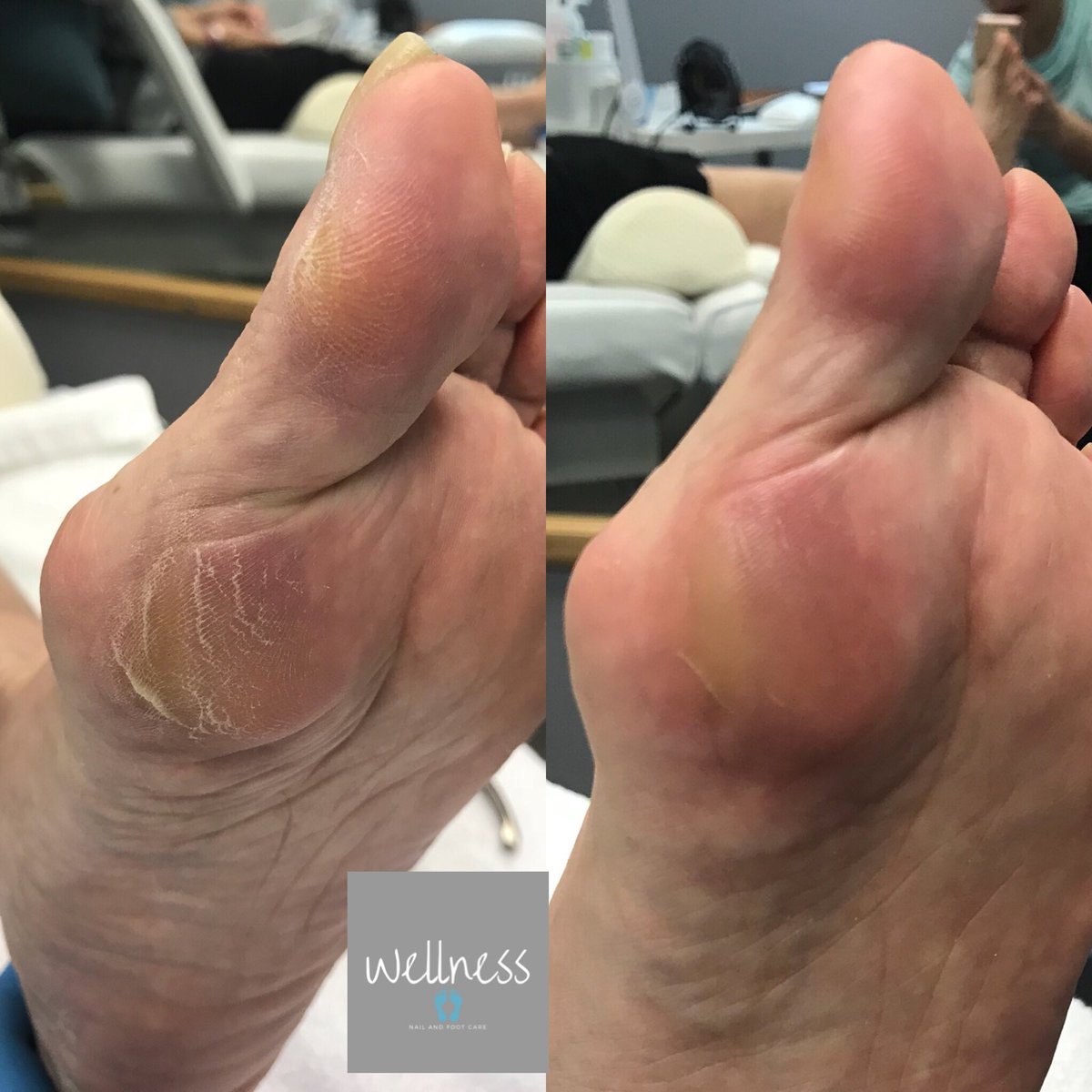 WellnessFoot tweet picture