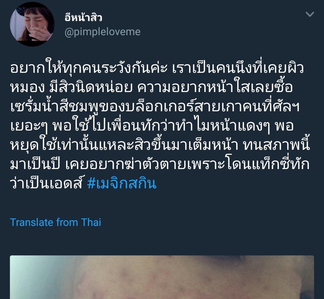 palimmms's tweet photo. สืบเนื่องจากทวิตของคุณคนนี้ นี่ขี้สงสัยเลยไปเสิชดู แล้วเจอรีวิวนี้ในพันทิป ดูรูปไปมากูก็เอะใจเล็กๆ ตีนไก่เกี่ยวอะไรกับเซรั่มนี้วะ หรือเค้าจะสกัดคอลลาเจนจากตีนไก่กันนะ พอเลื่อนลงไปดูความเห็นเท่านั้นแหละ อีดอกเอ้ยกุนี่ลั่นแบบลั่น 5555555555555555555555555555555555555555 #เมจิกสกิน https://t.co/fNN4X4nyoC