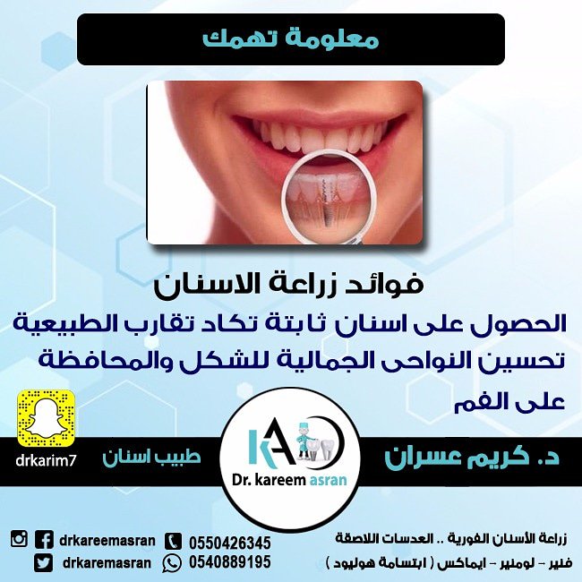 من فوائد #زراعة_الاسنان انها تحافظ
على شكل و #قوام العظم مكان #السن المفقود

#تجميل_اسنان
#تنظيف_اسنان
#تسوس_اسنان