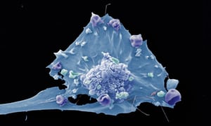 OpenTargets's tweet image. &quot;Why is #cancer the beast that stalks us all?&quot; @nathanlents tells us more @guardianscience, from his latest book #humanerrors. buff.ly/2Jfs2mk