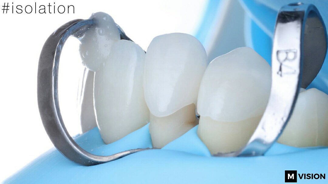 cristiansalim's tweet photo. [DIGITAL WORKFLOW IPS E.MAX]
#ivoclarvivadent #ipsemax #3shape 
• Fotografía: Dr Nazariy Mykhaylyuk https://t.co/ik4kYJmWpr