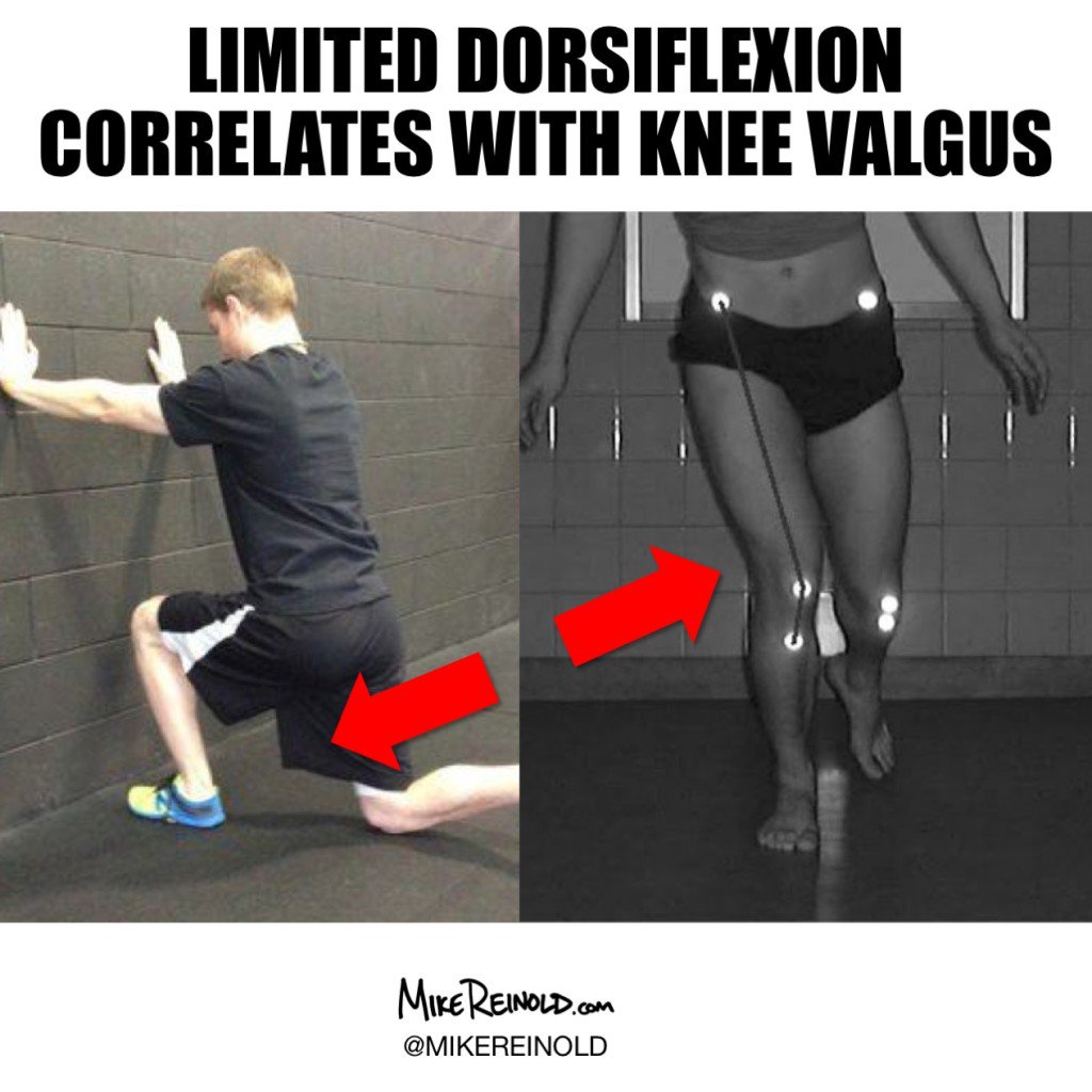 Limited Ankle Dorsiflexion Correlates to Poor Dynamic Knee Valgus physicaltherapyinsport.com/article/S1466-…