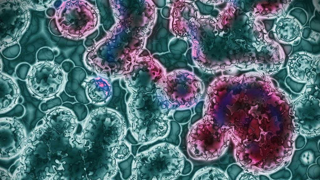 MayoClinic's tweet photo. #Leukemia is cancer of the body's blood-forming tissues, including the bone marrow and lymphatic system. Find out more about treatments for leukemia. https://t.co/cYU3ArGhVg https://t.co/NN0hPedLJy